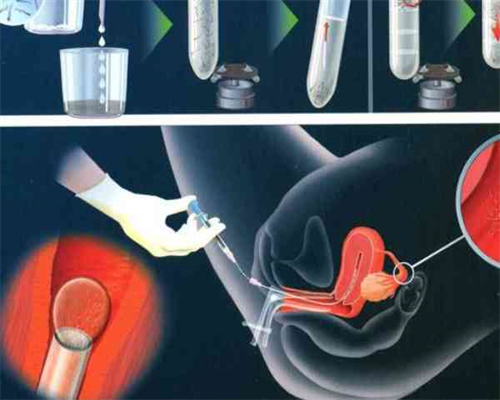 代孕机构客服电话,告别不孕不育 中药丸帮你轻松受孕