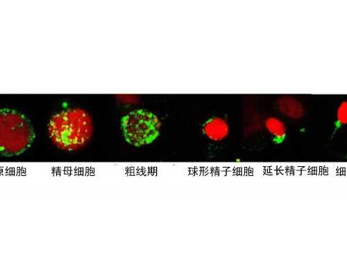 喜贝代孕,多囊卵巢综合征的表现有哪些？