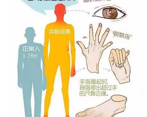 试管代孕服务优势,染色体罗氏易位和平衡易位有哪些不同，一次收费高吗？