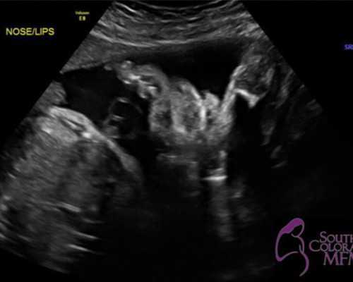 试管代生预约网二代冻胚转三代多少钱,二代试管代生预约网冻囊胚能转三代吗